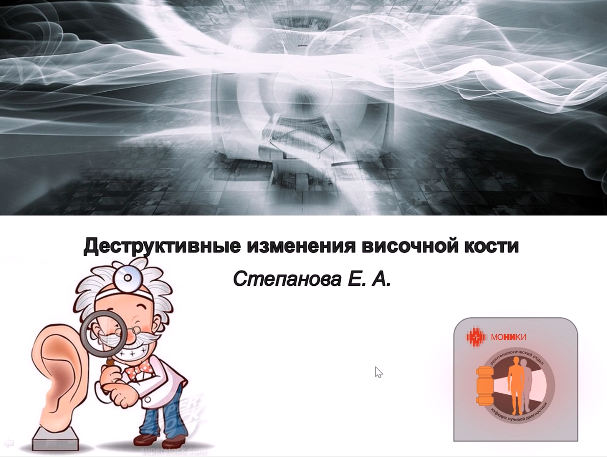 Лекция "Деструктивные изменения височной кости " врач- рентгенолог, к.м.н., ассистент кафедры Лучевой диагностики ФУВ ГБУЗ МО «МОНИКИ им М.Ф. Владимирского