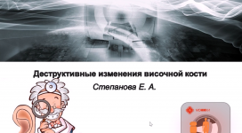 Лекция "Деструктивные изменения височной кости " врач- рентгенолог, к.м.н., ассистент кафедры Лучевой диагностики ФУВ ГБУЗ МО «МОНИКИ им М.Ф. Владимирского