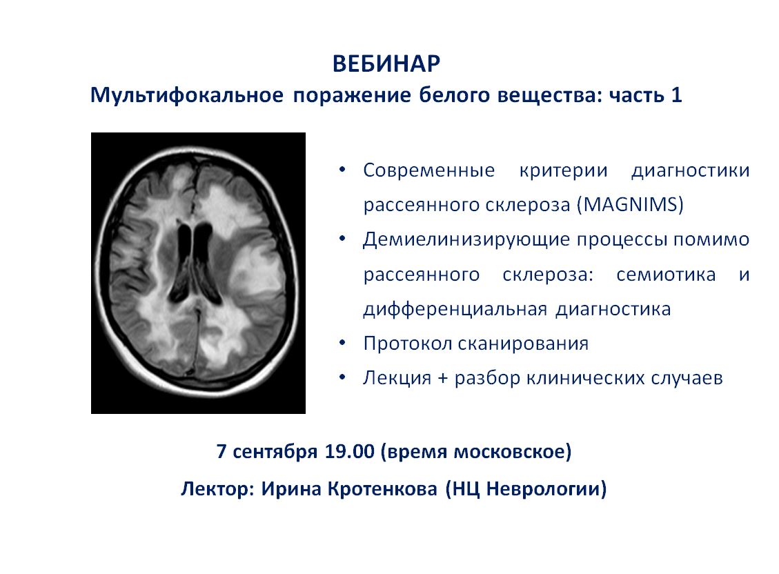 Многоочаговые поражения головного